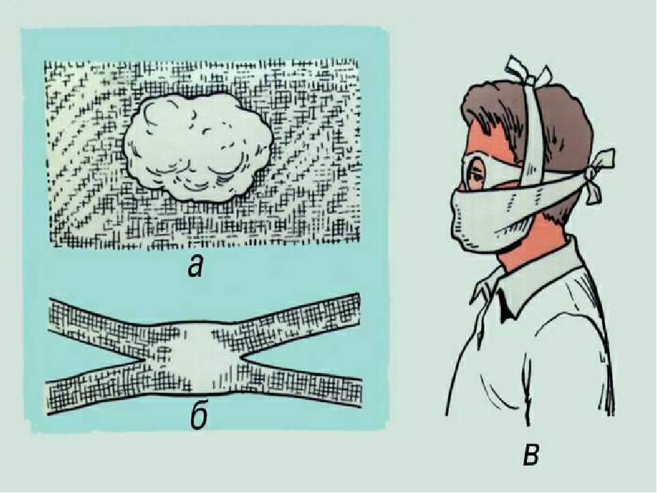 Как быстро сшить марлевую повязку – два простых способа (мк с фото)